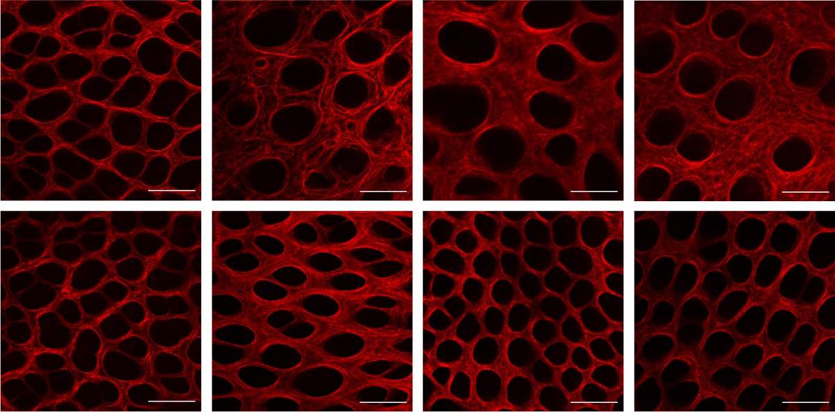 The extracellular matrix (red) in the colon of regular mice (top left) was disrupted by inflammation (top, center and right), whereas mice lacking HSF1 (bottom left) failed to develop inflammation under the same conditions, and their matrix remained normal over time (bottom, center and right)