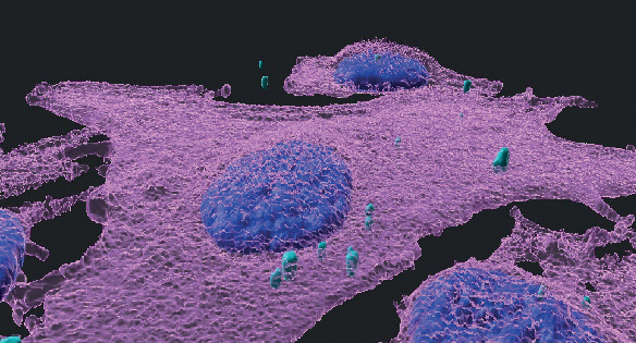 A 3D immunofluorescent image of melanoma cells (magenta) infected with bacteria (turquoise); cell nuclei are blue