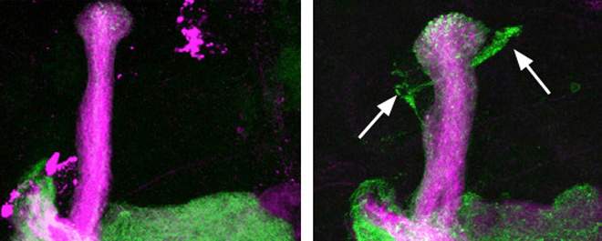 In the developing brain of a fruit fly, axons (green) are pruned when the Bsk gene functions properly (left), but not when this gene is mutated (right, arrows)