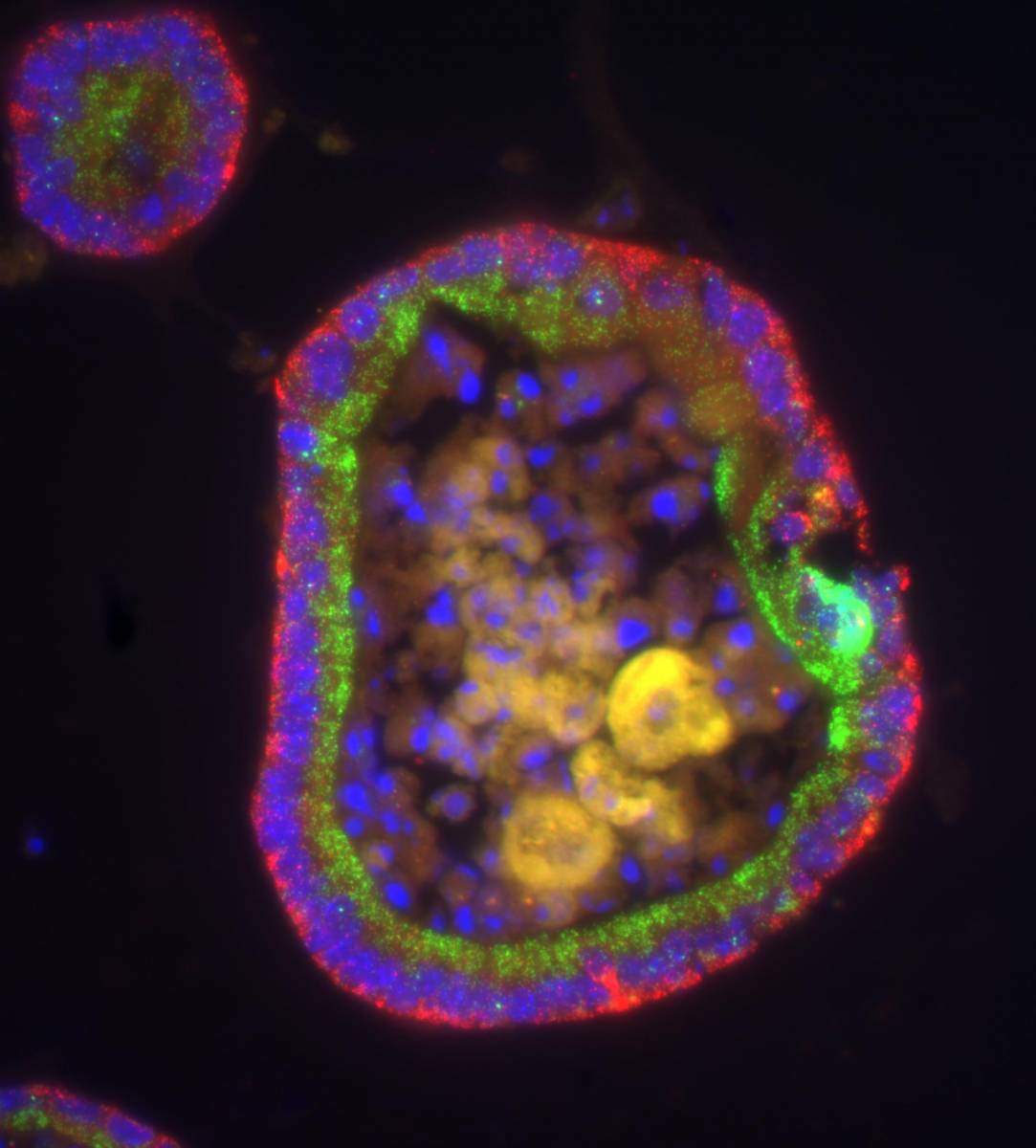 A circular organoid, about 0.5 mm in diameter, that mimics a cross-section of the gut in the test tube. In its outer layer, messenger RNA molecules of two different genes (red and green) are located on different sides of the cell nuclei (blue)