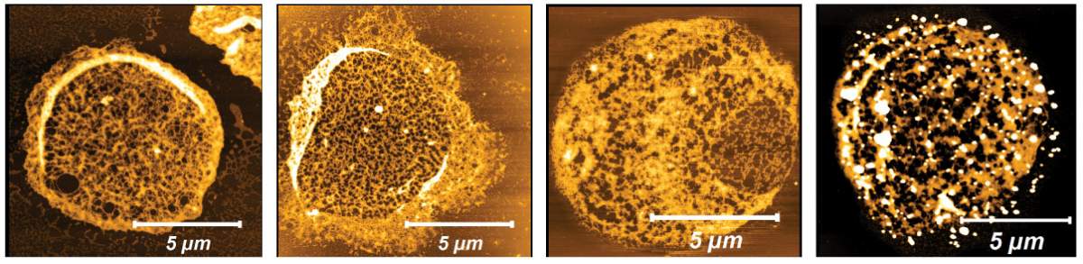 Cytoskeletons of red blood cells viewed with atomic force microscopy. Exposure to extracellular vesicles released by the malaria parasite caused filament melting (yellow, second from right) or the formation holes (black, far right), in contrast to controls (first and second from left)