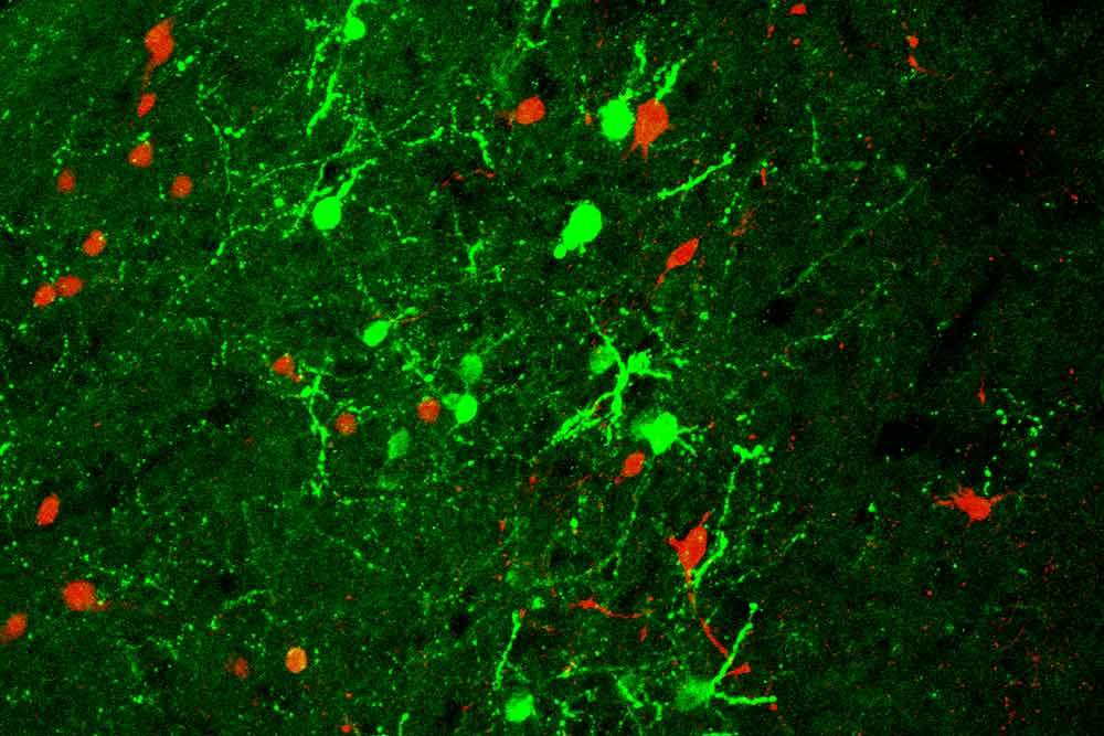 Stress-coping molecule Urocortin-3 (green) and its receptor, CRFR2 (red), expressed in the mouse brain region responsible for social behavior. Viewed under a confocal microscope