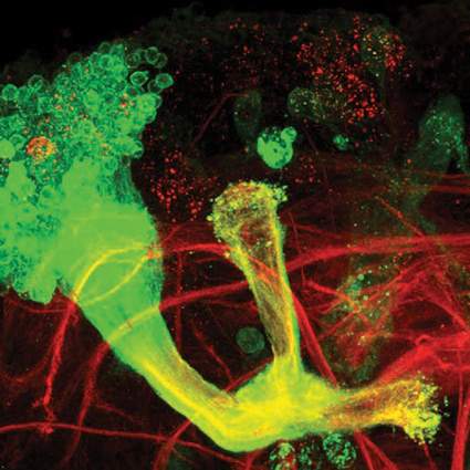 Unpruned axons in mutant fruit fly brain