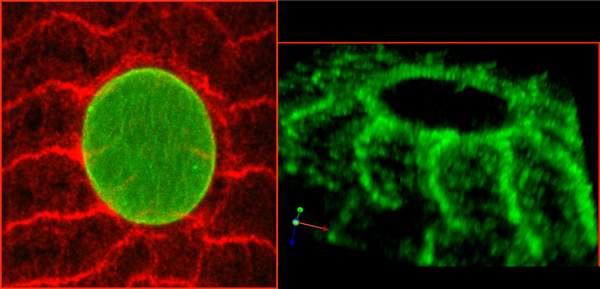 The MSP-300 protein, viewed here under a confocal microscope, forms a ring (red in the left image, green on the right) around the muscle cell nucleus, with extensions to the cytoskeleton
