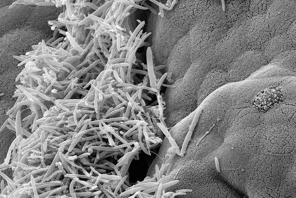 Electron microscope image reveals the close proximity of mouse intestinal cells to bacteria (threads)