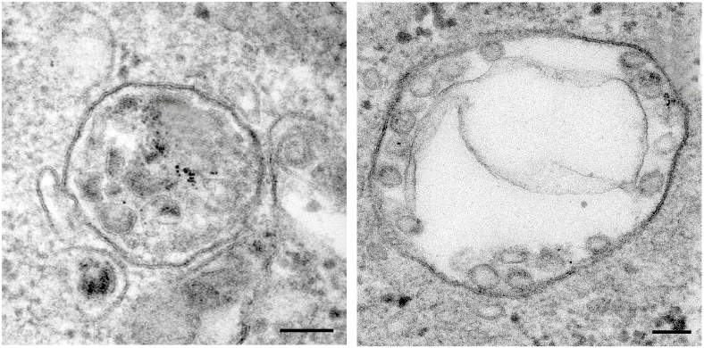 Left: Proteins slated for destruction or removal from the cell are temporarily contained in small vesicles within a multivesicular body (the large circular structure in the center). Right: In the absence of the MLKL protein, this “housekeeping” function is disrupted, and the vesicles intended for carrying the proteins further fail to develop properly. Viewed under an electron microscope