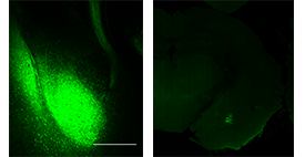 (l) The amygdala (bright green), the brain region that plays a central role in controlling emotions, sends neuronal extensions (the “cord” leading upwards) to the prefrontal cortex. (r) A highly specific set of neurons in the amygdala (bright green) that connect it with the prefrontal cortex. Viewed under a fluorescence microscope