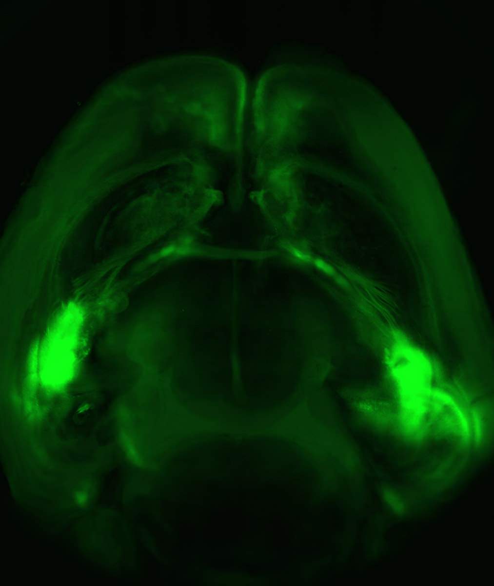 An entire mouse brain viewed from above: Neuronal extensions connect the two amygdalas (brightest green spots on both sides of the brain) with the prefrontal cortex (top)