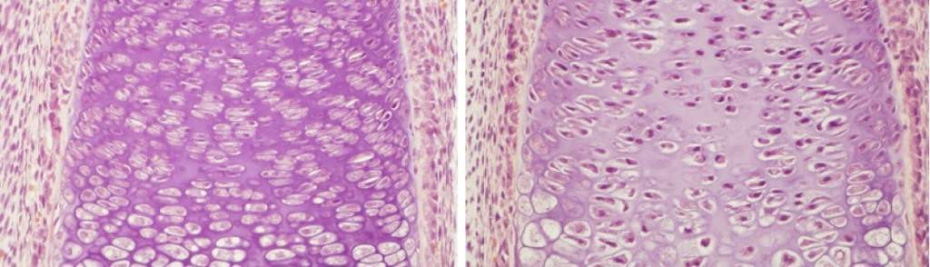 Cartilage cells in the growth plate of a developing bone. When the expression of the Hif1a gene is blocked, the number of cells in the growth plate’s low-oxygen zone is reduced and their supporting matrix is diminished (right)