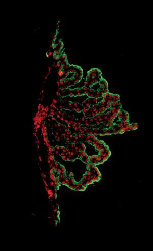 Immunofluorescence microscope image of the choroid plexus. Epithelial cells are in green and chemokine proteins (CXCL10) are in red