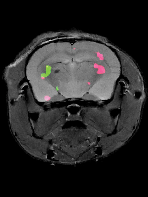 Two different proteins expressed in a mouse brain are revealed by dual-color MRI