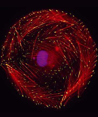 Non-polarized cell six hours after seeding onto a compliant fibronectin-coated substrate. Yellow shows paxillin, a protein associated with focal adhesions