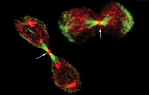Daughter cells struggling in vain to break apart