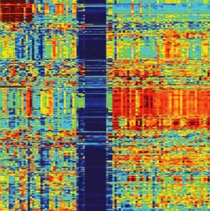 “Deregulation scores” of hundreds of brain tumor patients: Each row corresponds to a pathway (that is, a biochemical process), and each column to a sample taken from a patient. Every colored spot stands for a number – the value of the “deregulation score” of the corresponding pathway, as determined for a particular patient. Dark blue stands for the activity of the pathway in normal brain tissue, whereas dark red indicates a high level of deviation from normal behavior. The clearly distinct group of normal b