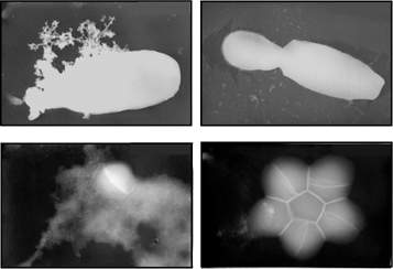 Electron microscope images of a yeast (Candida albicans) (top) and bacterial (Staphylococcus aureus) (bottom) cell, before (l) and after (r) treatment with synthetic lipopeptides, which damage their cell membranes