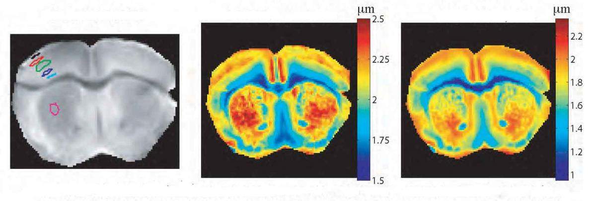 Mapping of size distributions of a mouse’s gray matter by quantum-controlled proton MRI. (l) Brain proton MRI; (c) mean cellular size; (r) distribution peak