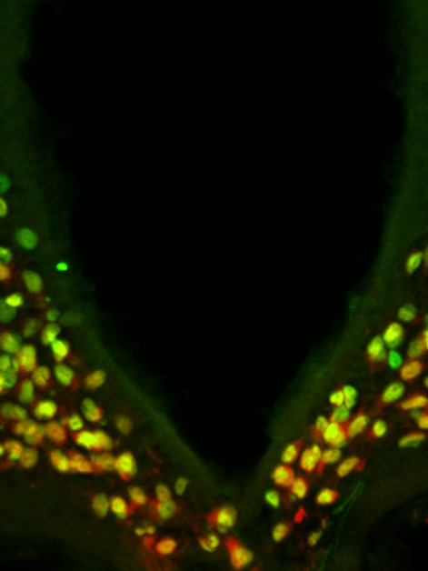 A portion of the mouse hypothalamus reveals that the protein made by the Otp gene (green) is expressed in all the neurons (red) that drive hunger – and the combined color is therefore yellow. It was known that in the developing brain, Otp is needed for the generation of these neurons. The study found that during adulthood, Otp is crucial for causing these neurons to express AgRP, a major hunger-promoting substance
