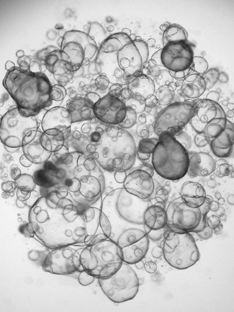 Intestinal organoids grown in the lab from stem cells derived from patients. Each sphere represents one organoid. Photo: Petro Busko, a PhD student in Biton’s lab