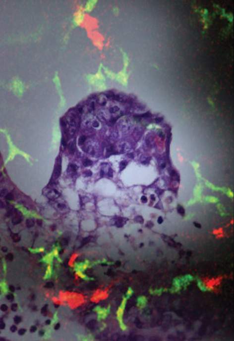 Image of an embryo overlaid withan immunofluorescent image of the decidua (purple). Dendritic cells are in green and blood vessels in red