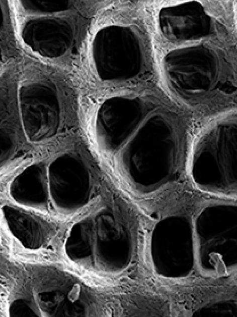 The extracellular matrix as captured by a scanning electron microscope (SEM)