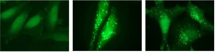 Cells growing under normal (l) and starvation (c and r) conditions. The green spots indicate an autophagy protein that is normally diffused in the cytoplasm, but is recruited to form autophagosomes in response to stress