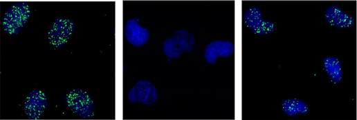 NPM1 interacts with DNA polymerase eta and regulates polymerase eta-promoted TLS. Assay of polymerase eta and NPM1 in unirradiated (l) and ultraviolet irradiated cells ((c) after one hour, (r) after 18 hours). Blue: DNA in the nucleus; green: polymerase eta–NPM1 interaction