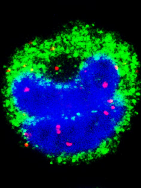 צבע אדום שמסיח את הדעת: מולקולות אר-אן-אי טפיליות (נקודות אדומות) שהצליחו לחדור לגרעיני תאים (כחול) של מונוציטים (ירוק)