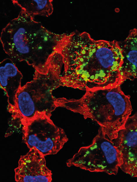 Infected macrophages