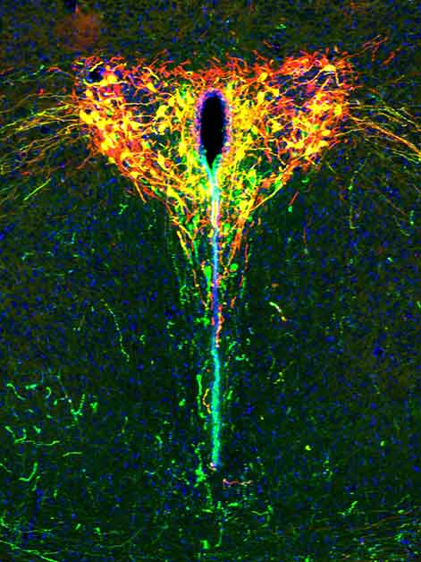 The developing brain of a two-week-old mouse pup under the microscope. The oxytocin system appears in green, the light-sensitive protein in red and cells that carry both show up in yellow. Cell nuclei are in blue
