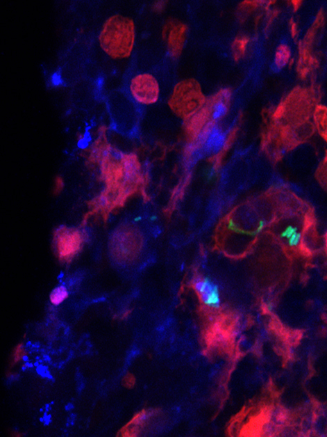 Fluorescence microscopy image of Salmonella (green) engulfed by splenic macrophages (red; blue – cell nuclei)