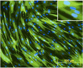 Human cells light up with green fluorescent markers after being penetrated by a genetically engineered virus coated with the VSV envelope protein