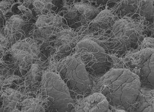  SEM image of the dense microbial ecosystem overlying the 'hilly' gastrointestinal epithelial layer