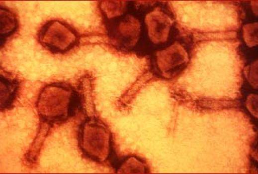 Tobacco mosaic virus