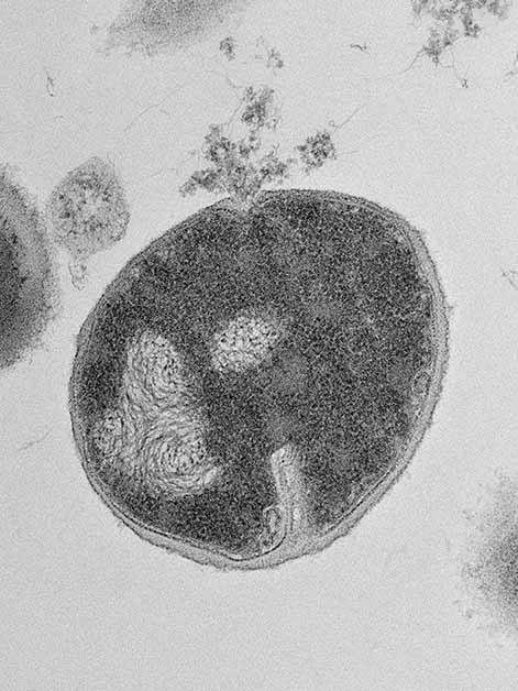Staphylococcus bacteria 