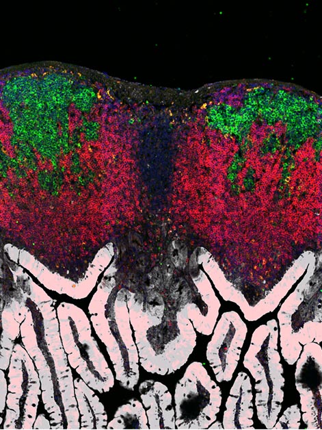 The inner lining of a mouse gut has finger-like projections (white) and harbors lymphatic organs (red) containing germinal centers (green). Viewed with confocal microscopy