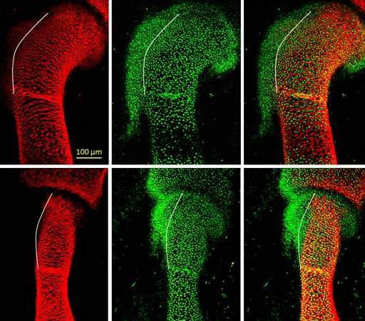 Developing bone in normal (top) and mutant (bottom) embryos. Protrusions in a developing bone are formed by a distinct class of cells (green) that differ from the regular bone-forming cells (yellow-orange). Incorrect regulation and distribution of these cells leads to irregularities in the shape of the forming bone 