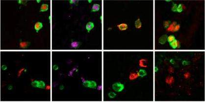 Embryonic stem cells (marked in green fluorescent protein) that should become sex cells, in which the gene encoding Utx is not present. Each column shows a gene needed for sex cell development (top row – marked in red, purple and orange). After 12 days (bottom row) the expression of the four genes has stopped and, rather than develop into sperm or ova, the stem cells die