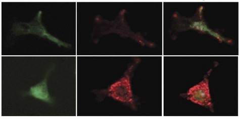 Prostaglandins guard stem cells by increasing the production of an inhibitory factor in the mesenchymal bone marrow cells. Mesenchymal cells are marked with a green protein (left); the inhibitory factor is red (center). Combined image (right): Treatment with prostaglandins (bottom) increases the secretion of the inhibitory factor