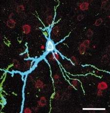 Overexpression of PKMzeta in the insular cortex. A merged picture of a neuron stained with GFP (green), PKMzeta (blue), and NeuN (red)