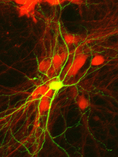 Inhibitory mouse neurons – viewed under a microscope