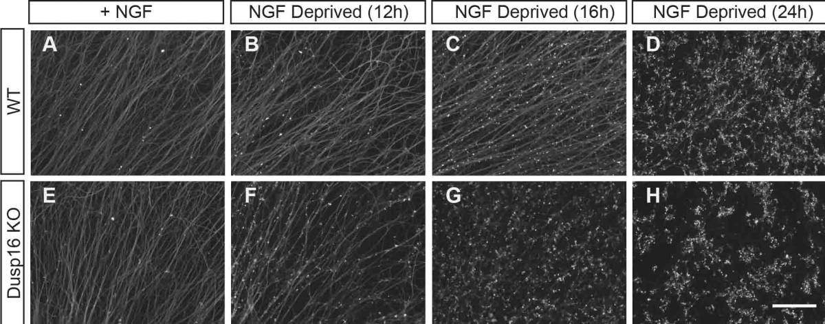 Upon trophic (NGF) withdrawal, axons degenerated earlier and at a faster rate in neurons lacking Dusp16 (bottom row) than the wild type neurons (top row), as can be seen from the punctuated pattern of axonal staining