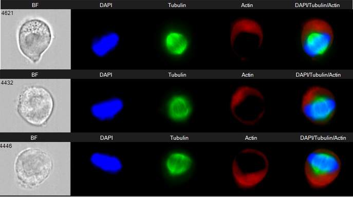 Dividing HeLa cells labeled for different elements: the cytoskeleton components actin and tubulin and DNA. In the right-hand image – showing all three – the tubulin fibers can be seen pulling the chromosomes apart prior to cell division 
