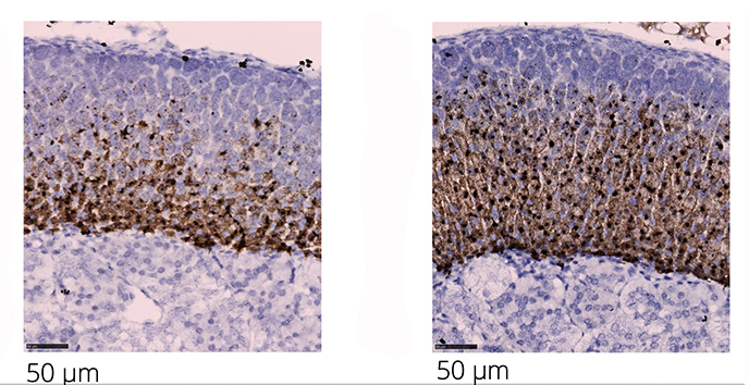 Adrenal glands from control (l) and stressed mice (r) show the mRNA expression of Abcb1b (brown staining), revealing the expression is limited to cells in the inner zone of the adrenal cortex. Scale bars 50 microns