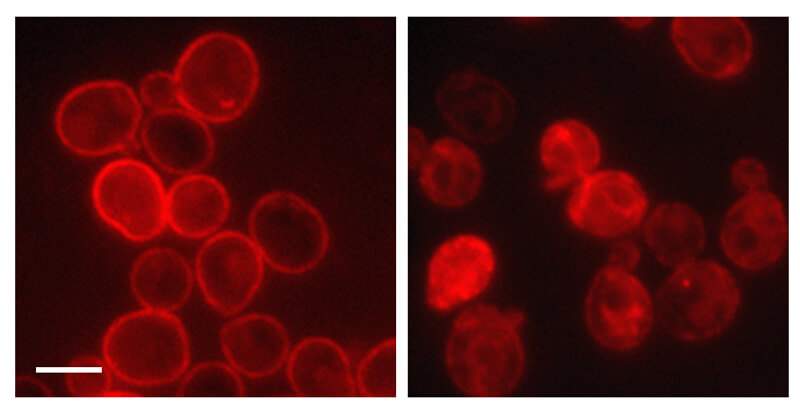 The protein Gas1, fused to a red fluorescent protein, is disposed to creating “clogs” in the gates to the secretory pathway. In a normal cell (left), clogs are removed so some protein makes it to the cell surface; in the cells at right, the “declogger” Ste24 is missing and Gas1 accumulates at the entrance to the secretory pathway