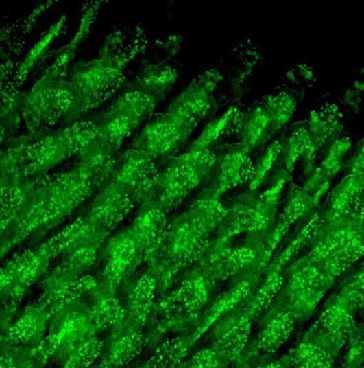 In the gut: Macrophages visualised as green cells in reporter mice