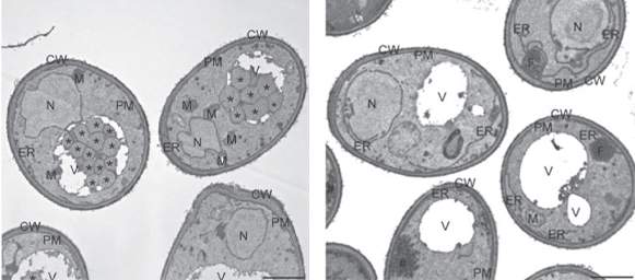 Electron microscopic images reveal autophagy taking place in specialized structures (marked by *) in regular yeast cells (left), but not in cells that lack lipid droplets (right) 