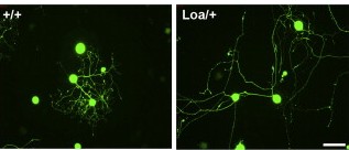 Neurons from wild type (left) and dynein mutant (right) mice grown in culture. The mutant neurons with lower dynein levels show longer axon growth
