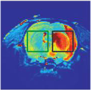 Magnetic resonance image of a rat’s brain subjected to a partial stroke in the right hemisphere (black square); the left hemisphere remained intact (green square)