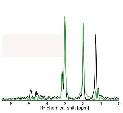Graphs of magnetic resonance spectra illustrate how the levels of metabolites in the brain’s hemisphere affected by stroke (black) were altered compared with those in the healthy hemisphere (green)