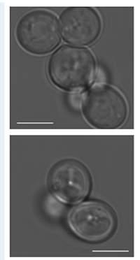 Light microscopy image of the yeast cells with adequate nutrition (top) and starvation (bottom)